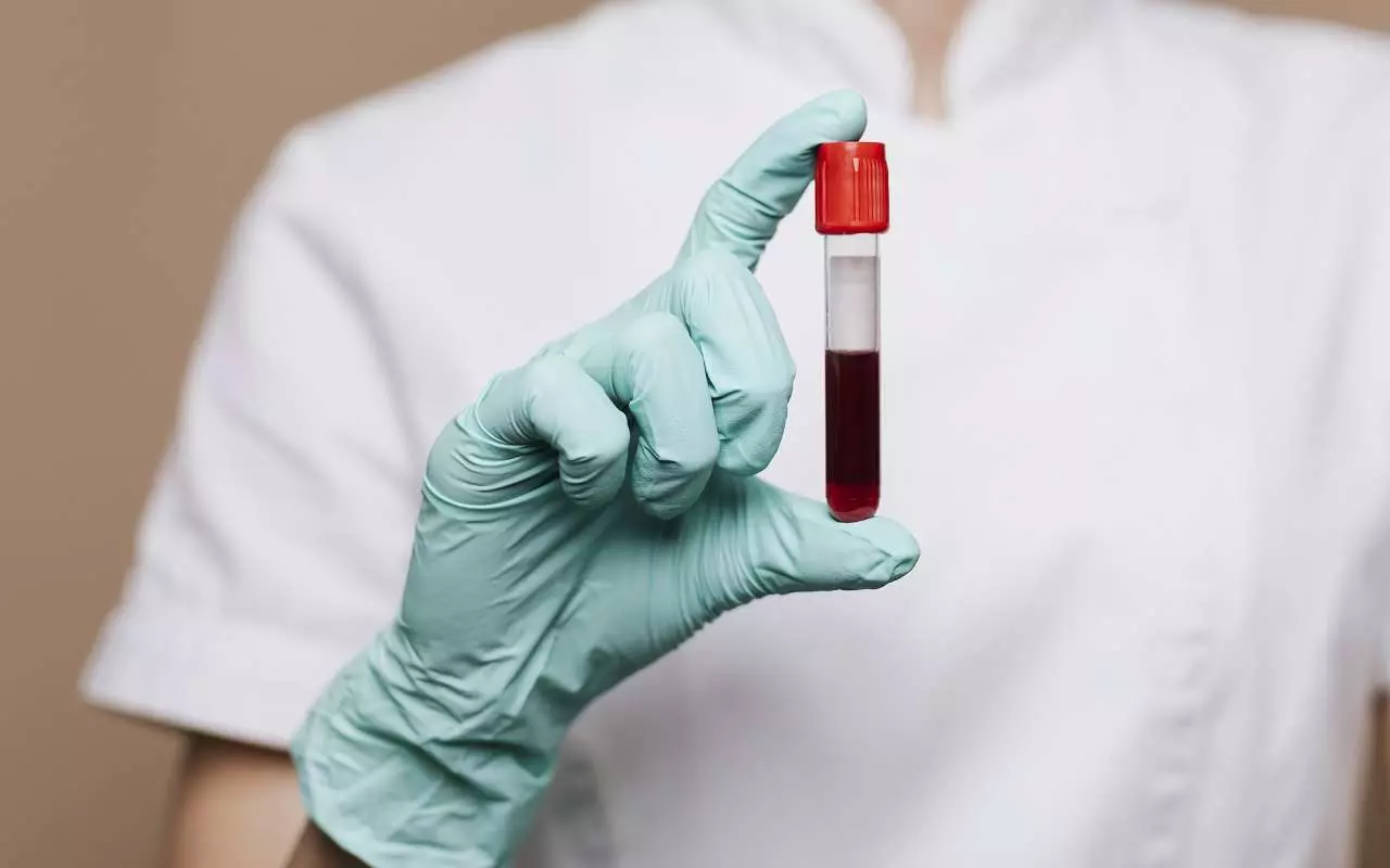 Etsimme vapaaehtoisia tutkimukseen, jossa selvitetään hormonaalisten muutosten vaikutusta naisten sydän- ja verisuonijärjestelmän terveyteen.